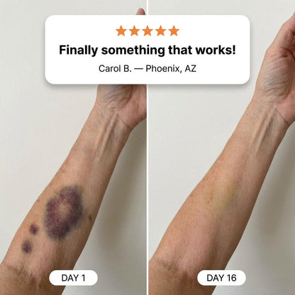 💥100K+ SOLD💕Bruise Repair & Skin-Strengthening Cream